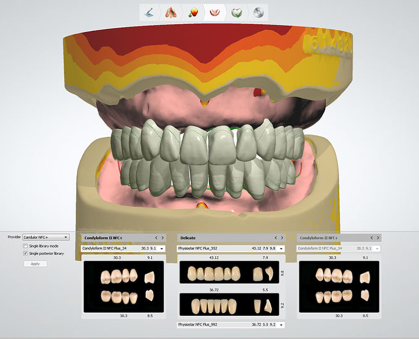 Le logiciel de modélisation 3Shape Dental System
