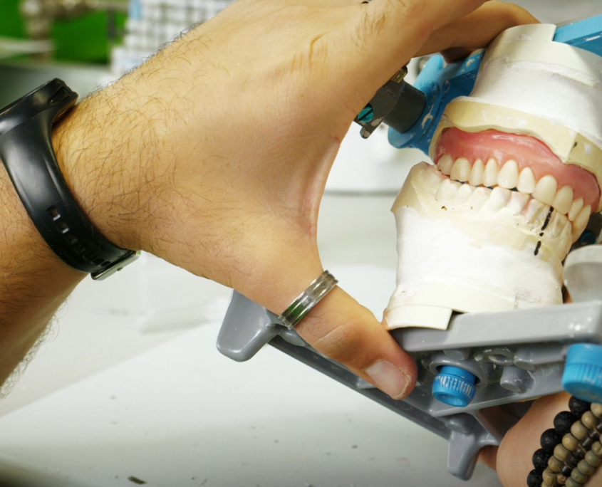DentikLab Prohèse adjointe résine