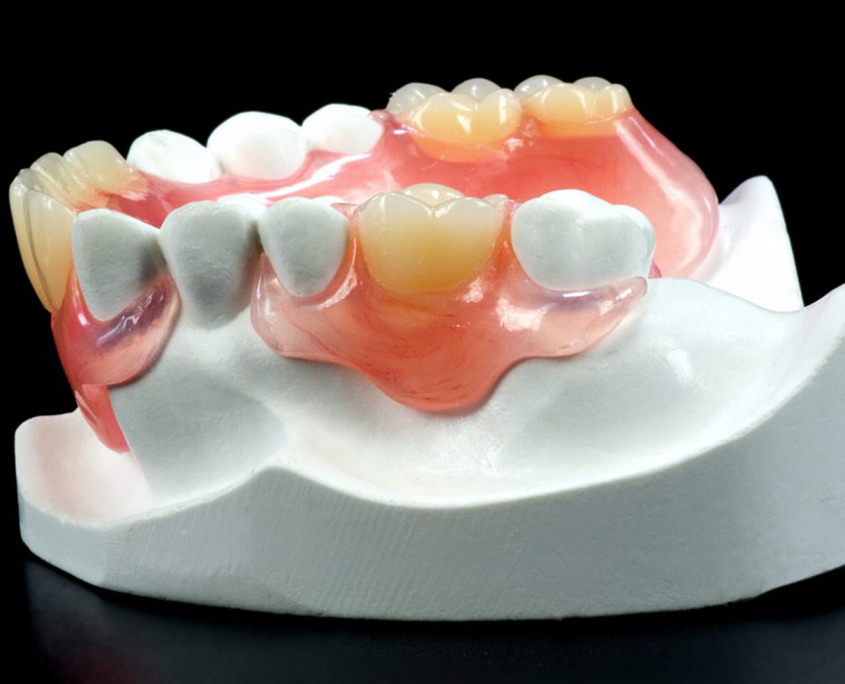 PROTHESE ADJOINTE BIO COMPATIBLE