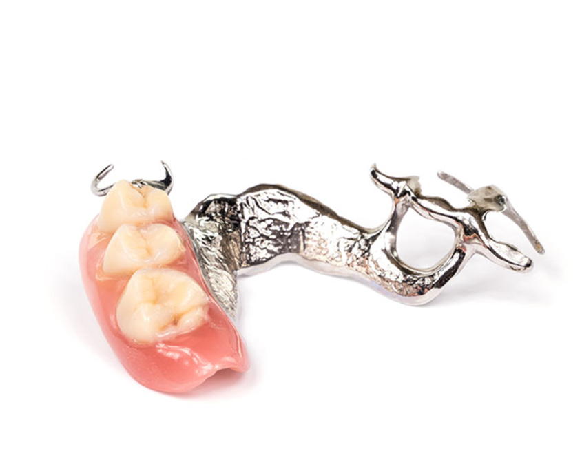 PROTHESE ADJOINTE DENTIKLAB