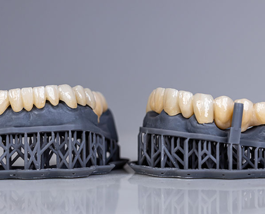 Prothese conjointe Dentiklab Prothese conjointe Dentiklab
