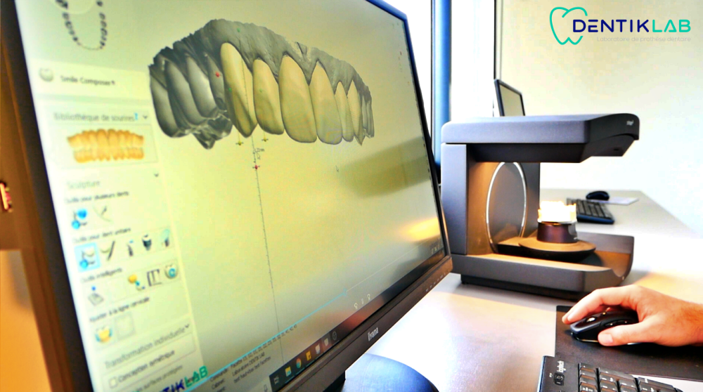 3shape Partenaire incontournable de Dentiklab