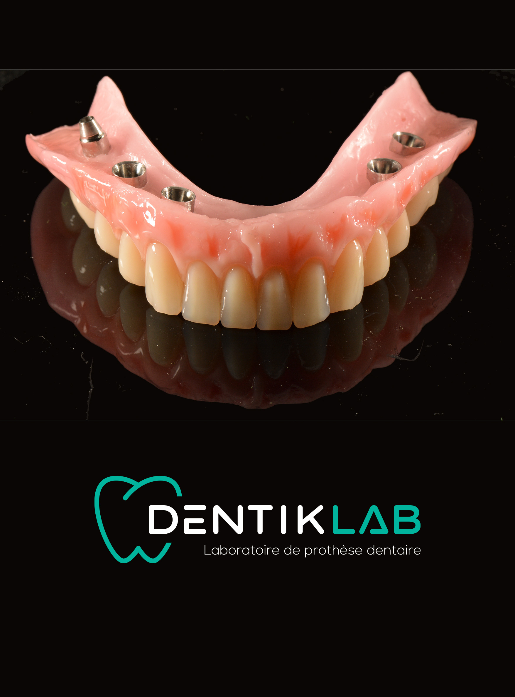 Dentiklab, chirurgie guidée plurale